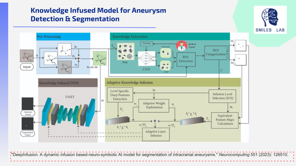 Cuatro diagramas. El título dice Modelo infundido de conocimiento para la detección y segmentación de aneurismas Logotipo de SMILES en la parte superior derecha. Arriba a la izquierda El preprocesamiento tiene varias comparaciones de imágenes de aneurismas. Las flechas conducen hacia abajo a Knowledge Infused DNN y a Knowledge Extraction en la parte superior derecha. Ese cuadro muestra la capacitación de expertos médicos sobre el modelo y comentarios de ida y vuelta para la extracción y categorización del ROI. Partes de esto conducen al cuadro inferior derecho y alimentan a la selección del nivel de infusión y al cálculo de mapas de características equivalentes; hay algunas ilustraciones de cuadros negros y secciones de explotación de peso adaptable, infusión de capa adaptable, así como extracción de características profundas específicas del nivel. Estos regresan a la sección DNN infundida de conocimiento en la parte inferior izquierda y conducen a Resultados de detección y Resultados de segmentación. La parte inferior dice: "DeepInfusion: un modelo de IA neurosimbólico basado en infusión dinámica para la segmentación de aneurismas intracraneales". Neurocomputación 551 (2023): 126510.